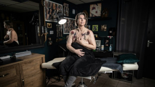 Free tattoos give hope for Dutch breast cancer survivors 