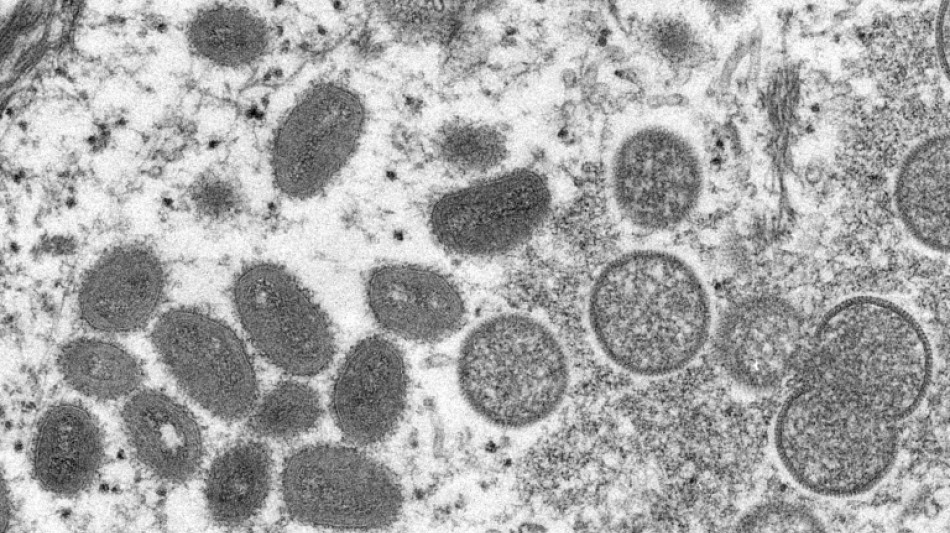 Variole du singe: des symptômes plutôt différents chez les premiers cas européens